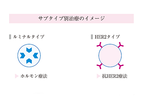 薬物療法とタイプ別治療