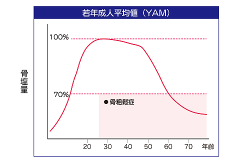 原発性骨粗鬆症 若年成人平均値