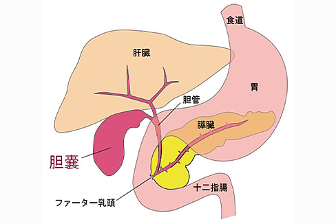 胆嚢をとる手術イメージ